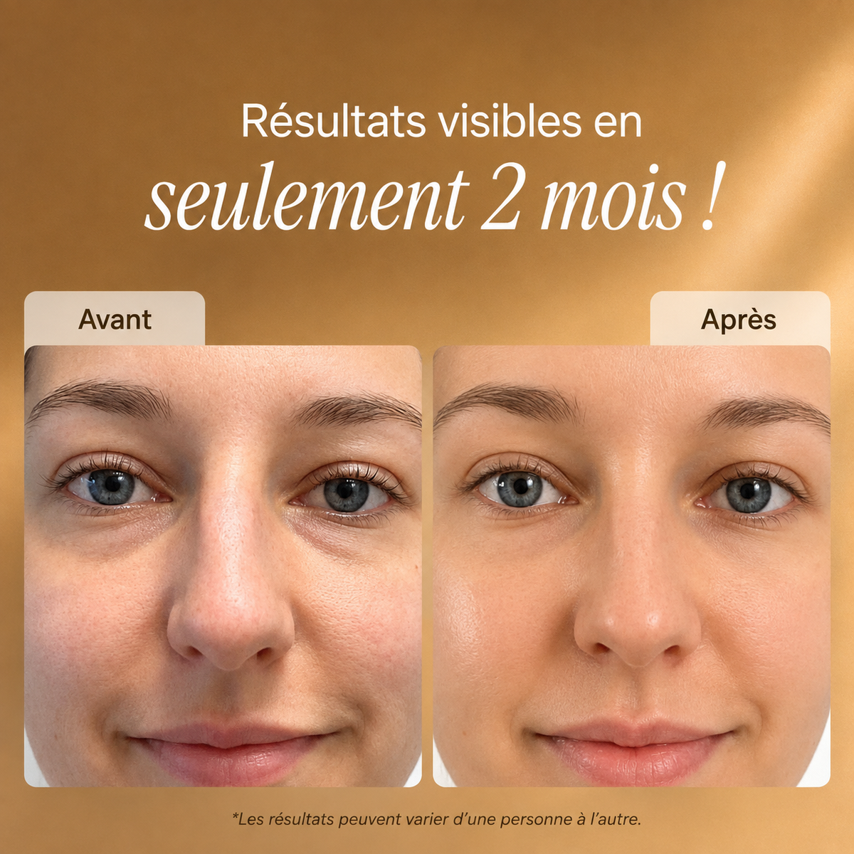 DERMOVA Masque LED Visage & Cou