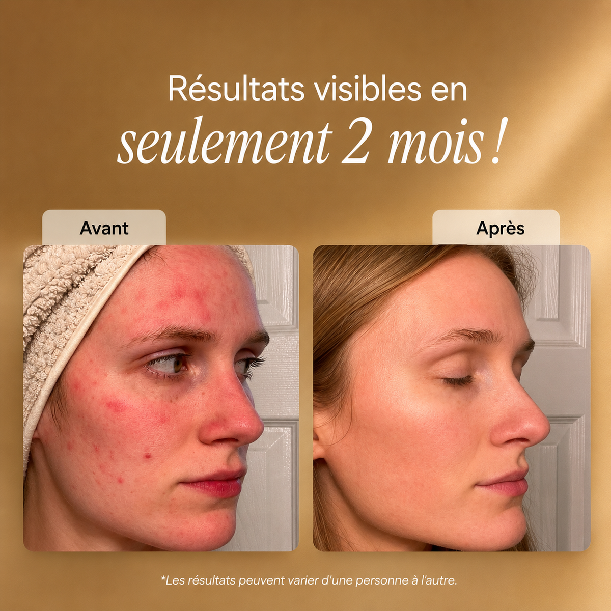 DERMOVA Masque LED Visage & Cou